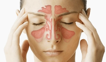 Endoskopik Sinüs Cerrahisi